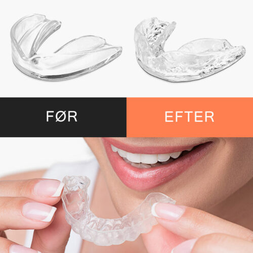 SLEEP BETTER - Softbite Bettskena